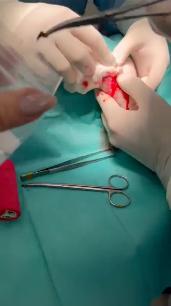 Surgery Step 1