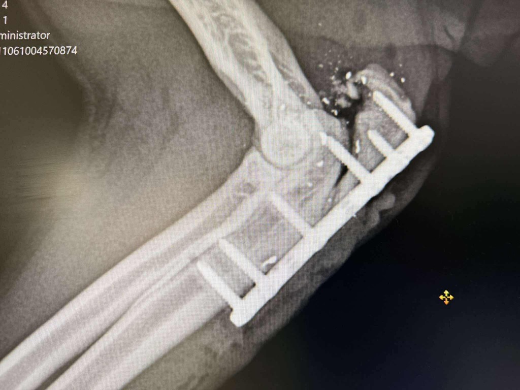 Oliver X-Ray 2